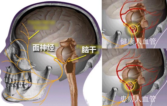 漡Ѫ-1.jpg