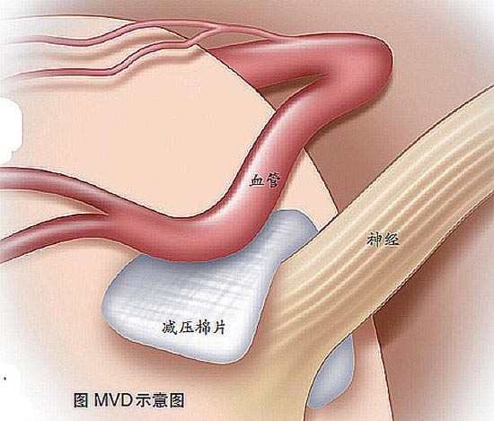 漡ͼ1.jpg