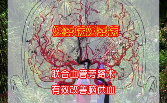 1-ԹѪ-1.jpg