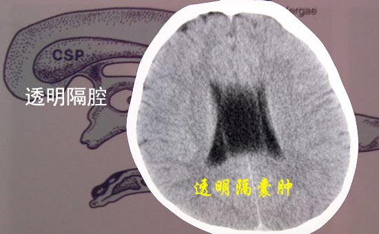 ͸ǻ-1.jpg