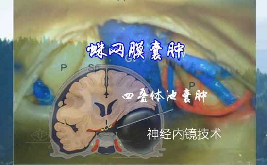 1ĵ-1.jpg