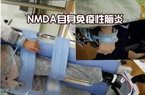 NMDA-1.jpg