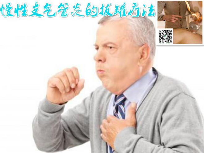 1487814509442840.jpg 慢性支气管炎的拔罐疗法.jpg