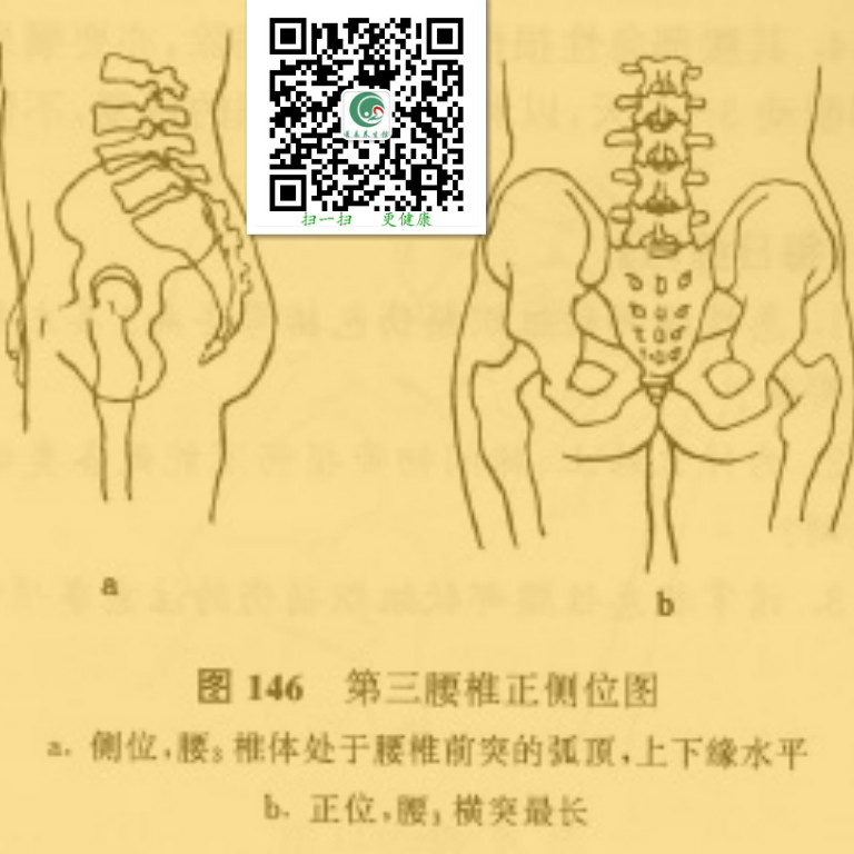 莆田:第三腰椎横突综合征指压疗法