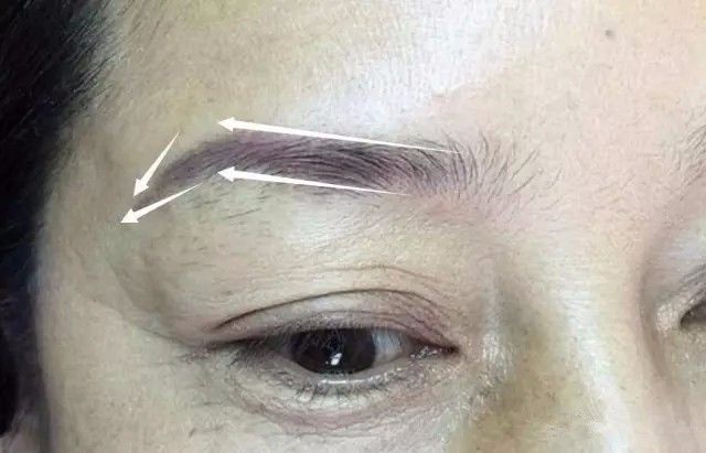 韩式半永久培训 老式纹眉发蓝发红怎么改?眉详细步骤