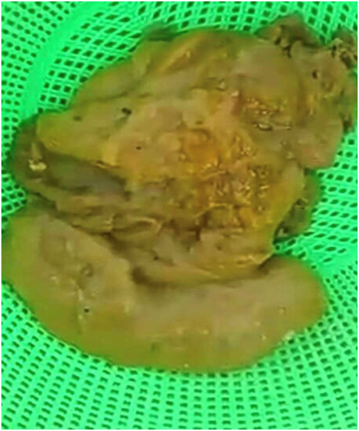 blob.png