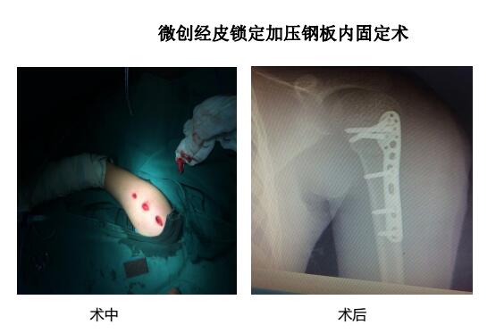 QQ؈D20180914103307.jpg