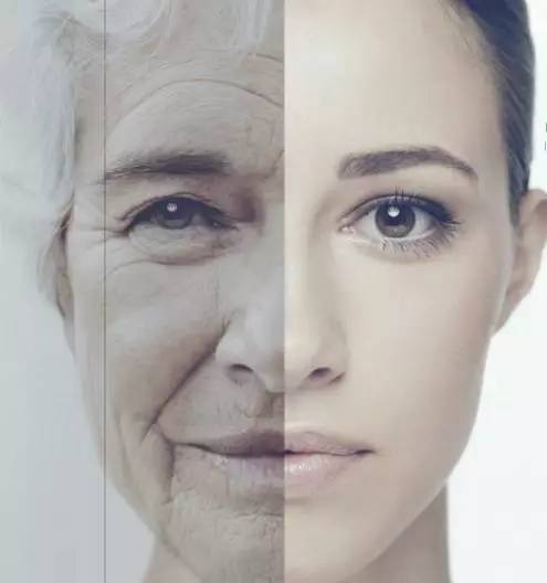 脸部组织顺着重要的悬吊韧带堆积, 形成难看的"三八线"